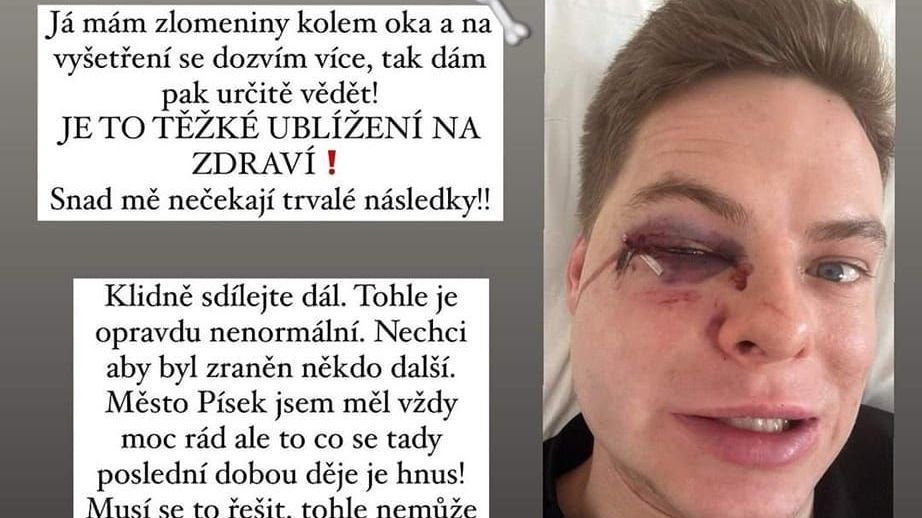 Za napadení youtubera z Písku obvinili policisté muže a dva mladistvé